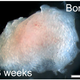 Image for article titled Scientists grow teeth from human urine because why the hell not